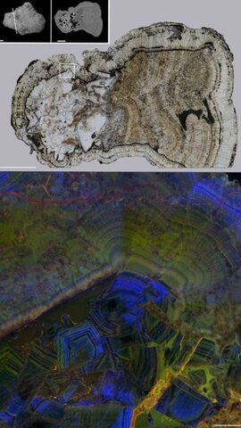 Fluorescence micrograph of a human kidney stone